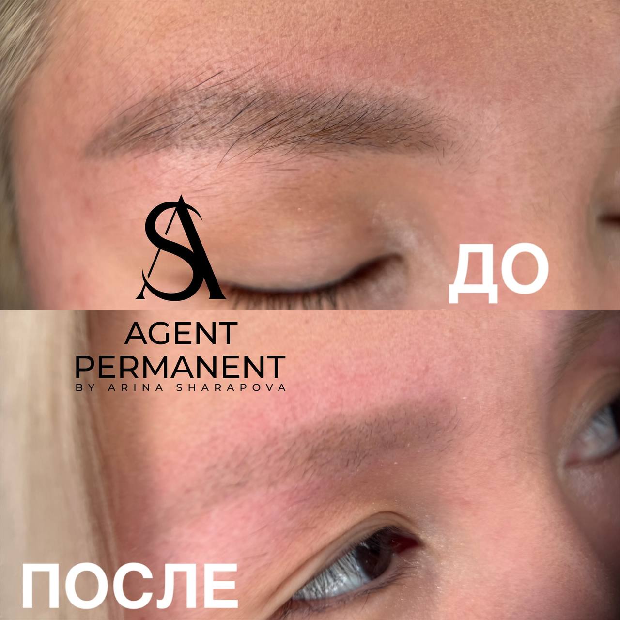 Удаление перманентного макияжа — работа Арины Шараповой, Agent Permanent, Москва