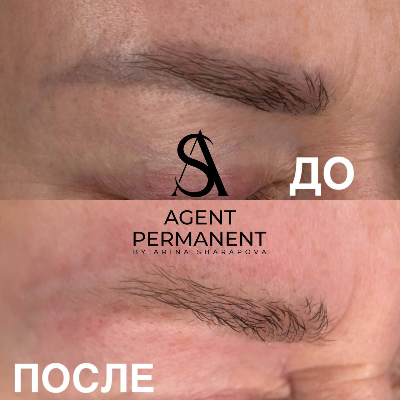 Удаление перманентного макияжа — работа Арины Шараповой, Agent Permanent, Москва